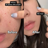 Dr. Althea 345 Relief Cream ⭐ The Ultimate Blemish & Glow Cream  ⭐ 100% Original Korean Skin Magic