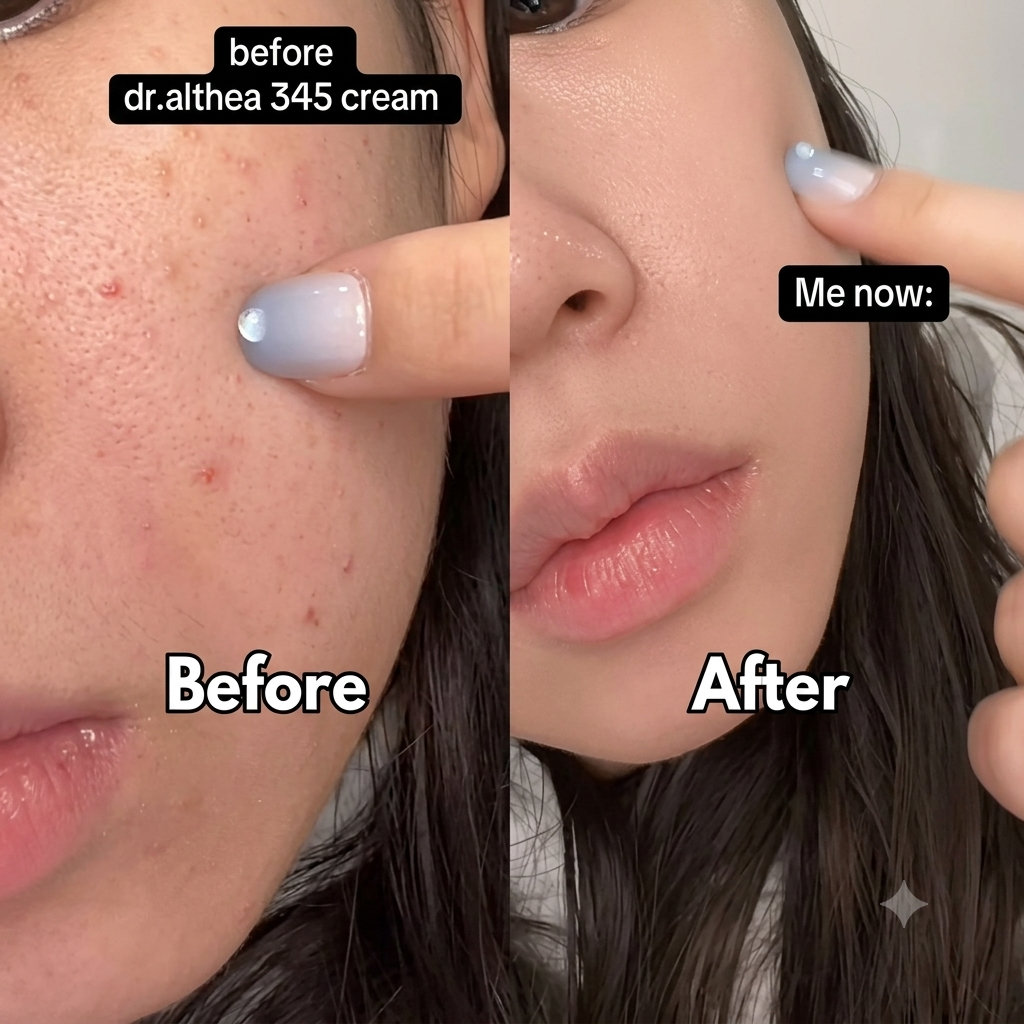 Dr. Althea 345 Relief Cream ⭐ The Ultimate Blemish & Glow Cream  ⭐ 100% Original Korean Skin Magic